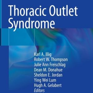 Thoracic Outlet Syndrome (2nd Edition)