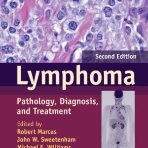 Lymphoma (Pathology, Diagnosis, and Treatment) (2nd Edition)