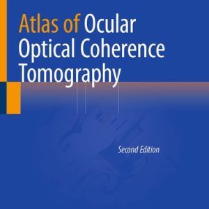 Atlas of Ocular Optical Coherence Tomography (2nd Edition)