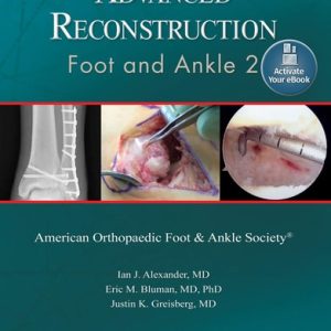 Advanced Reconstruction: Foot and Ankle 2 (2nd Edition)