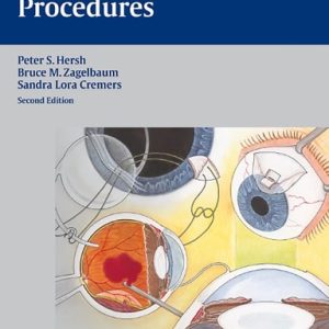 Ophthalmic Surgical Procedures (2nd Edition)