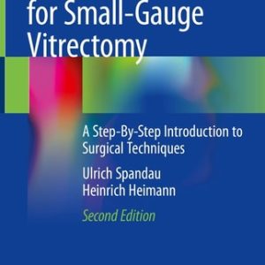Practical Handbook for Small-Gauge Vitrectomy (A Step-By-Step Introduction to Surgical Techniques) (2nd Edition)