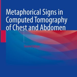 Metaphorical Signs in Computed Tomography of Chest and Abdomen (2nd Edition)