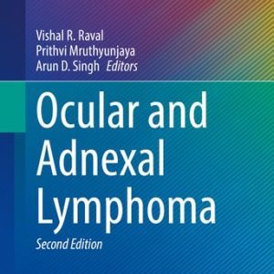 Ocular and Adnexal Lymphoma (2nd Edition)