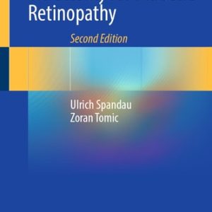 Small-Gauge Vitrectomy for Diabetic Retinopathy (2nd Edition)