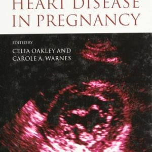 Heart Disease in Pregnancy (2nd Edition)