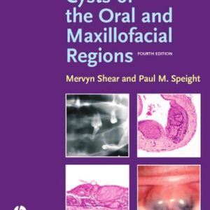Cysts of the Oral and Maxillofacial Regions (4th Edition)