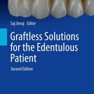 Graftless Solutions for the Edentulous Patient (2nd Edition)