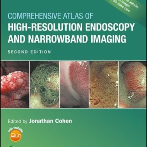 Comprehensive Atlas of High-Resolution Endoscopy and Narrowband Imaging (2nd Edition)