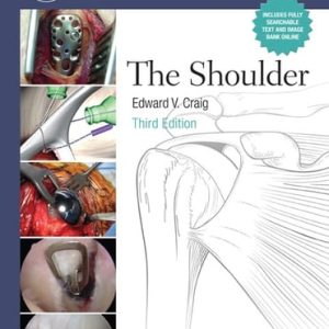 The Master Techniques in Orthopaedic Surgery: Shoulder (3rd Edition)