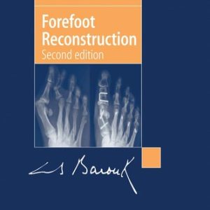 Forefoot Reconstruction (2nd Edition)