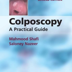 Colposcopy (A Practical Guide) (2nd Edition)