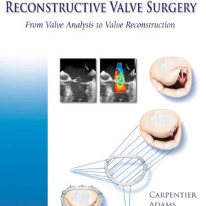Carpentier’s Reconstructive Valve Surgery (1st Edition)