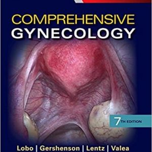 Comprehensive Gynecology (7th Edition)