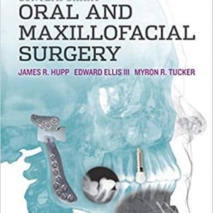 Contemporary Oral and Maxillofacial Surgery (6th Edition)