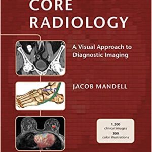 Core Radiology: A Visual Approach to Diagnostic Imaging
