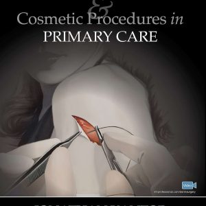 Dermatologic Surgery and Cosmetic Procedures in Primary Care Practice