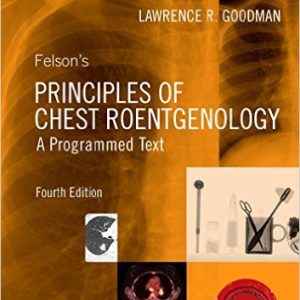 Felson’s Principles of Chest Roentgenology (4th Edition)