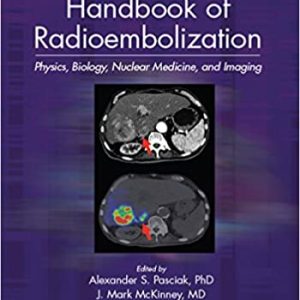 Handbook of Radioembolization: Physics; Biology; Nuclear Medicine; and Imaging