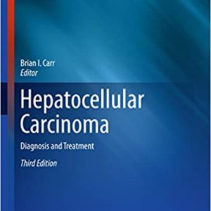 Hepatocellular Carcinoma: Diagnosis and Treatment (3rd Edition)