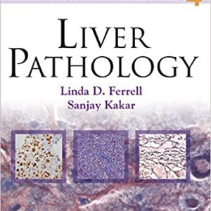 Liver Pathology (Consultant Pathology Book 4)