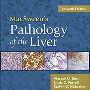 MacSween’s Pathology of the Liver (7th Edition)