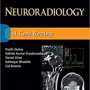 Neuroradiology: A Core Review