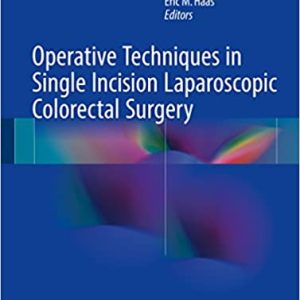 Operative Techniques in Single Incision Laparoscopic Colorectal Surgery