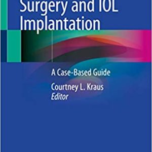 Pediatric Cataract Surgery and IOL Implantation: A Case-Based Guide