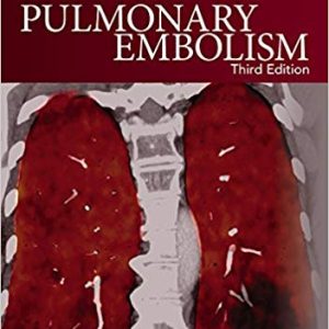 Pulmonary Embolism (3rd Edition)