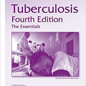 Tuberculosis: The Essentials (4th Edition)