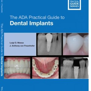 The ADA Practical Guide to Dental Implants (1st Edition)