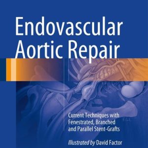 Endovascular Aortic Repair Current Techniques with Fenestrated, Branched and Parallel Stent-Grafts (1st Edition)