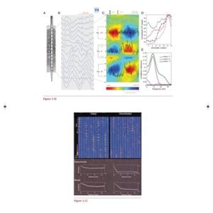Niedermeyer's Electroencephalography Basic Principles, Clinical Applications, and Related Fields (6th Edition)