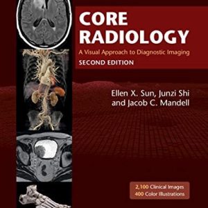 Core Radiology A Visual Approach to Diagnostic Imaging (2nd Edition)