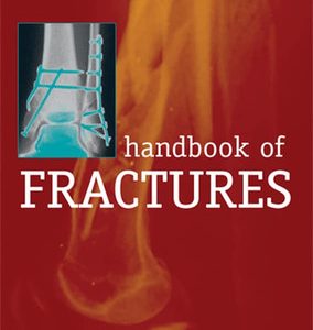Handbook of fractures (3rd Edition)