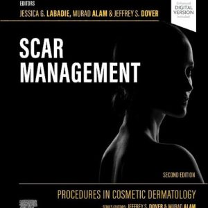 Procedures in cosmetic dermatology: scar management (2nd Edition)