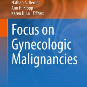Focus on gynecologic malignancies (2018th Edition)