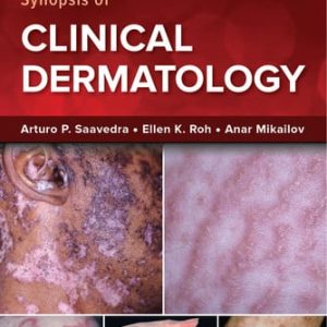 Fitzpatrick's color atlas and synopsis of clinical dermatology (9th Edition)