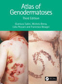 Atlas of genodermatoses (3rd Edition)