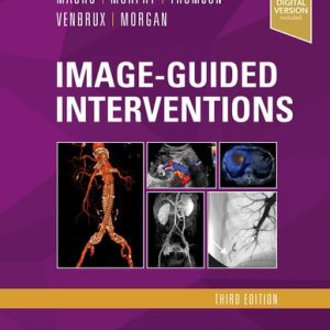 Image-guided interventions (3rd Edition)