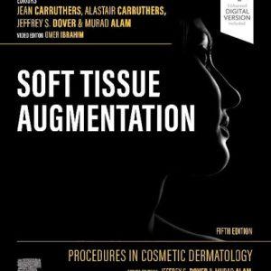 Soft tissue augmentation - (5th Edition)
